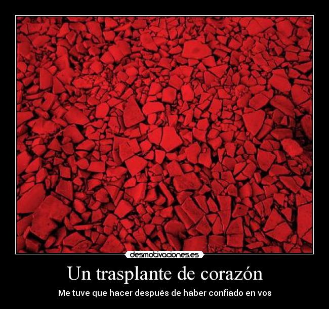 Un trasplante de corazón -