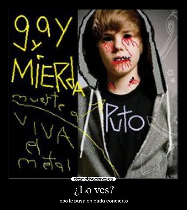 ¿Lo ves? - eso le pasa en cada concierto