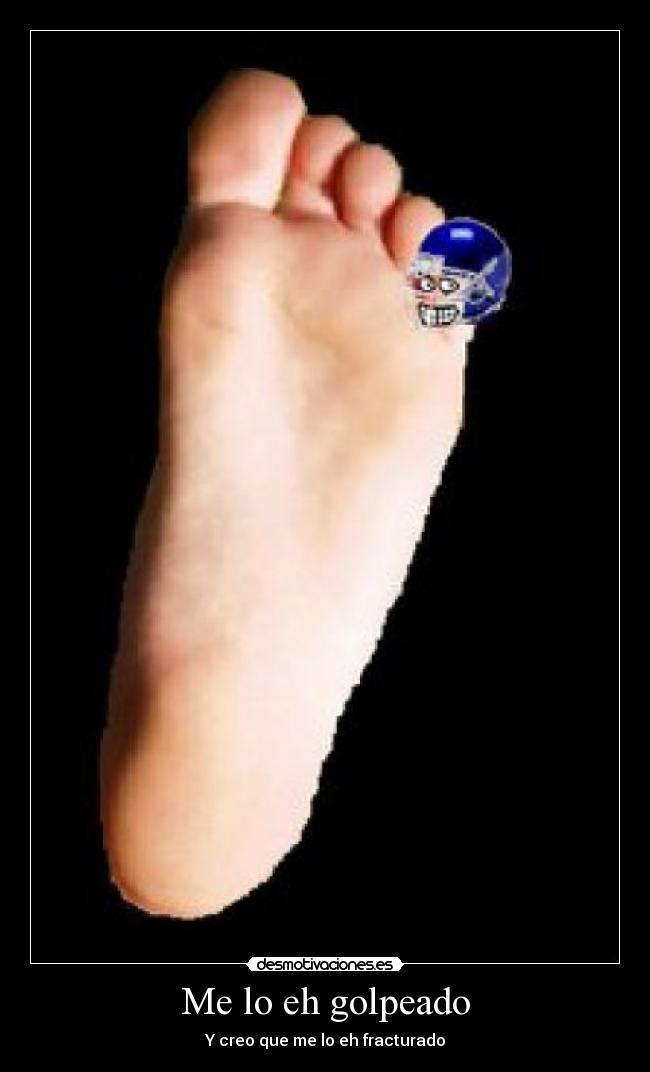 Me lo eh golpeado - Y creo que me lo eh fracturado