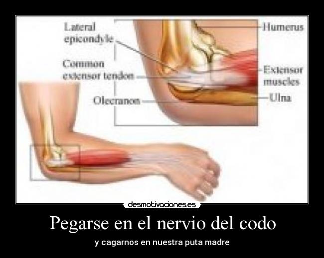 Pegarse en el nervio del codo - y cagarnos en nuestra puta madre