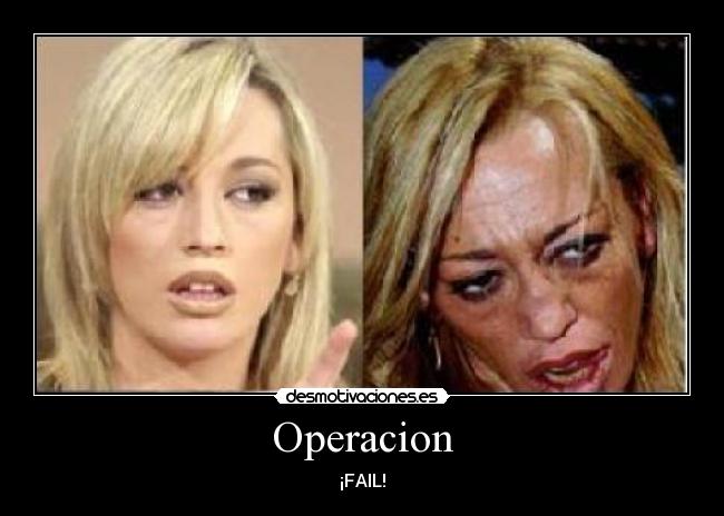 Operacion -