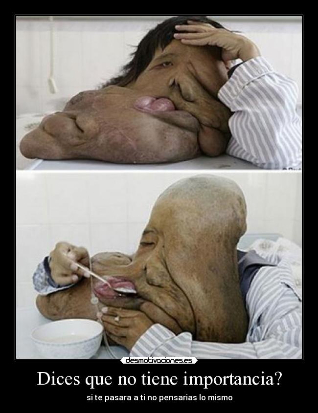 Dices que no tiene importancia? -