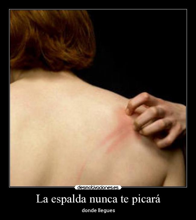 La espalda nunca te picará -