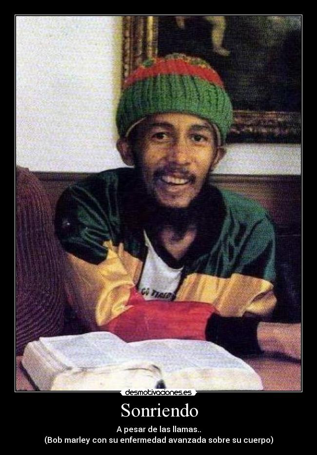 Sonriendo - A pesar de las llamas..
(Bob marley con su enfermedad avanzada sobre su cuerpo)