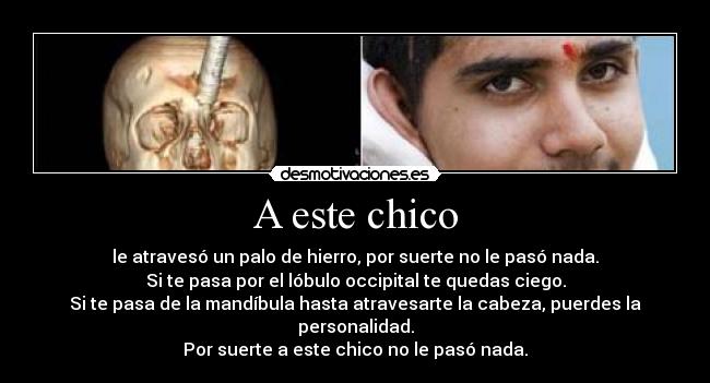 A este chico - le atravesó un palo de hierro, por suerte no le pasó nada.
Si te pasa por el lóbulo occipital te quedas ciego.
Si te pasa de la mandíbula hasta atravesarte la cabeza, puerdes la personalidad.
Por suerte a este chico no le pasó nada.