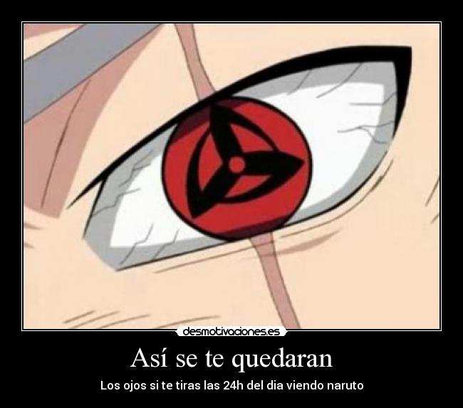 Así se te quedaran - Los ojos si te tiras las 24h del dia viendo naruto