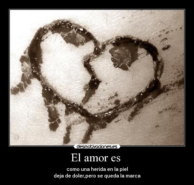 El amor es - como una herida en la piel
deja de doler,pero se queda la marca