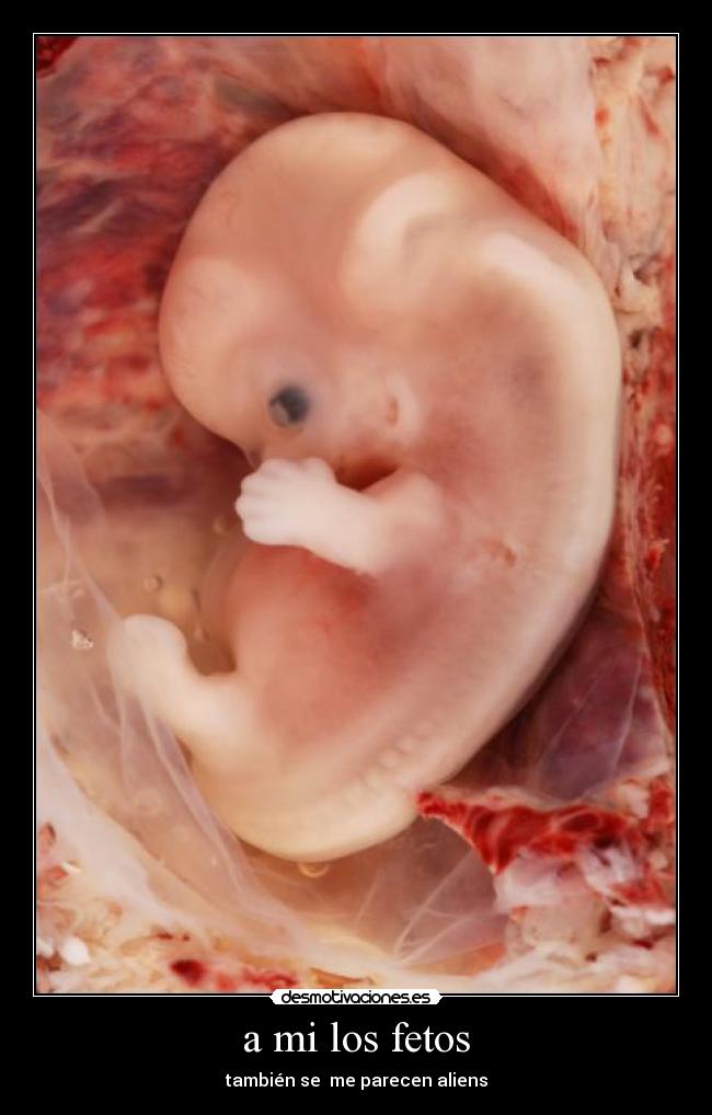 a mi los fetos - 