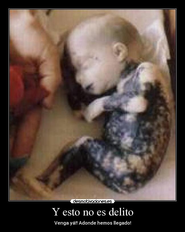 Y esto no es delito -