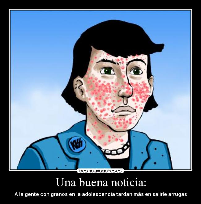 Una buena noticia: - A la gente con granos en la adolescencia tardan más en salirle arrugas