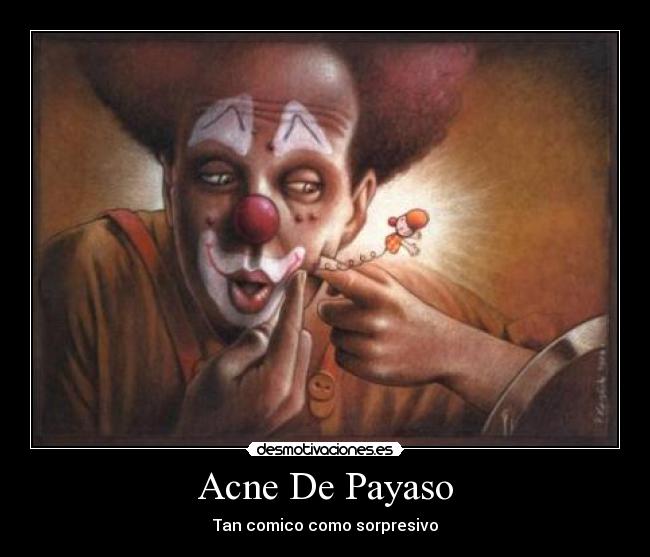 Acne De Payaso -