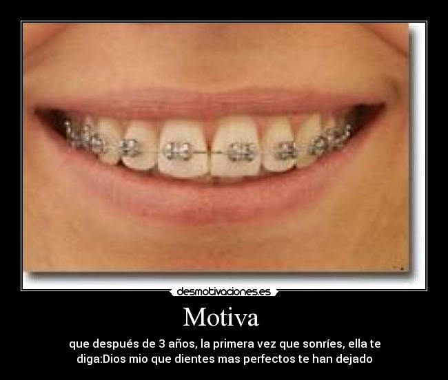 Motiva - que después de 3 años, la primera vez que sonríes, ella te
diga:Dios mio que dientes mas perfectos te han dejado