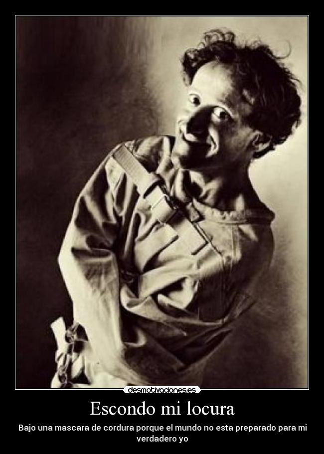 Escondo mi locura - 