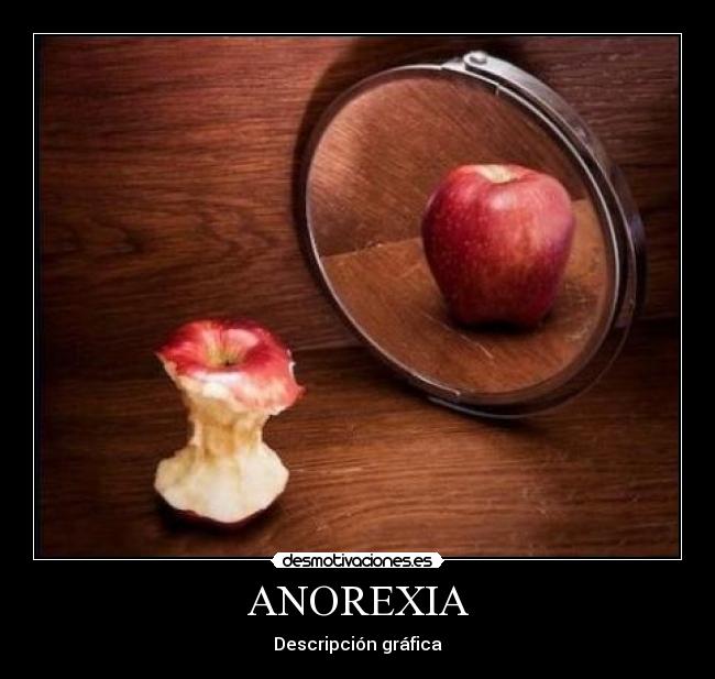 ANOREXIA -