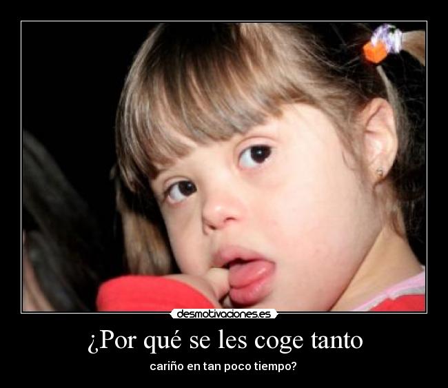 ¿Por qué se les coge tanto - 