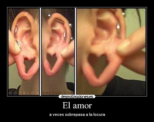 El amor - a veces sobrepasa a la locura