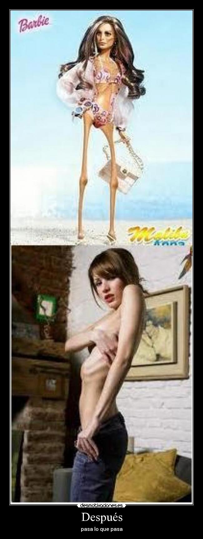 Después -