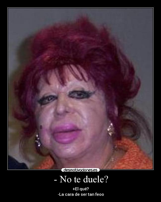 - No te duele? - +El qué?
-La cara de ser tan feoo