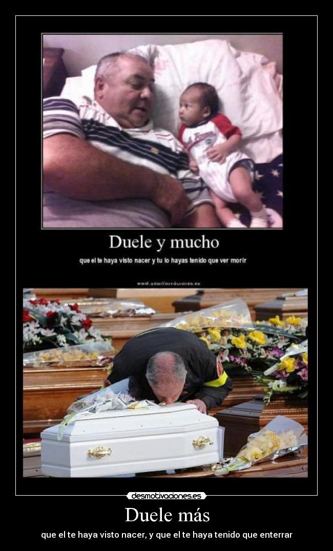 Duele más -