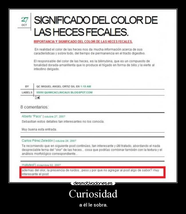 Curiosidad - a él le sobra.