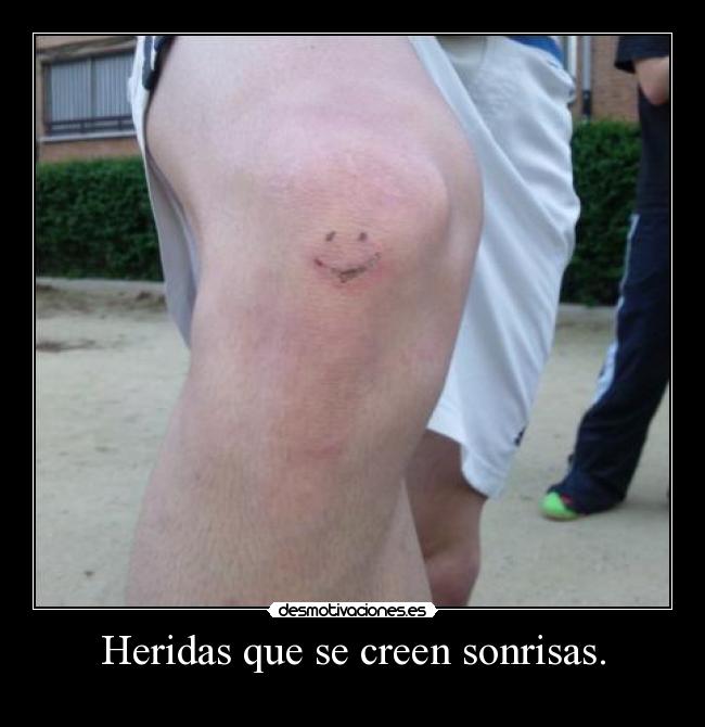Heridas que se creen sonrisas. -