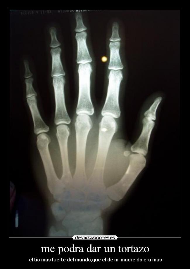 me podra dar un tortazo -