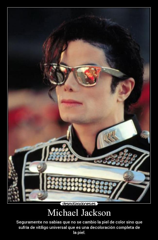 Michael Jackson - Seguramente no sabias que no se cambio la piel de color sino que
sufría de vitíligo universal que es una decoloración completa de
la piel.