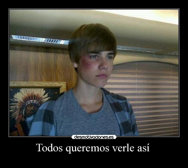Todos queremos verle así -