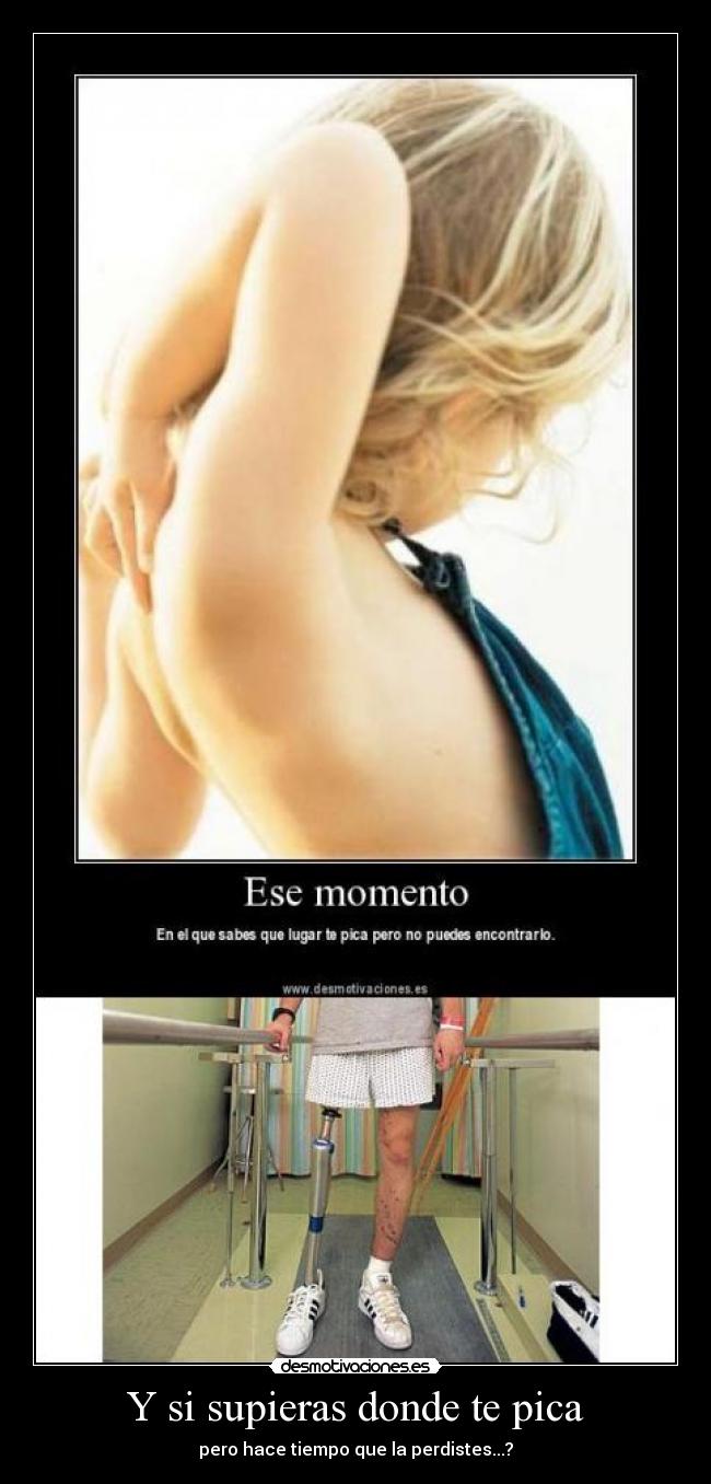 Y si supieras donde te pica - pero hace tiempo que la perdistes...?