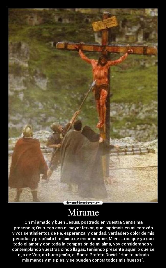 Mírame - ¡Oh mi amado y buen Jesús!, postrado en vuestra Santísima
presencia; Os ruego con el mayor fervor, que imprimais en mi corazón
vivos sentimientos de Fe, esperanza, y caridad, verdadero dolor de mis
pecados y propósito firmísimo de enmendarme; Mient ...ras que yo con
todo el amor y con toda la compasión de mi alma, voy considerando y
contemplando vuestras cinco llagas, teniendo presente aquello que se
dijo de Vos, oh buen jesús, el Santo Profeta David: Han taladrado
mis manos y mis pies, y se pueden contar todos mis huesos.