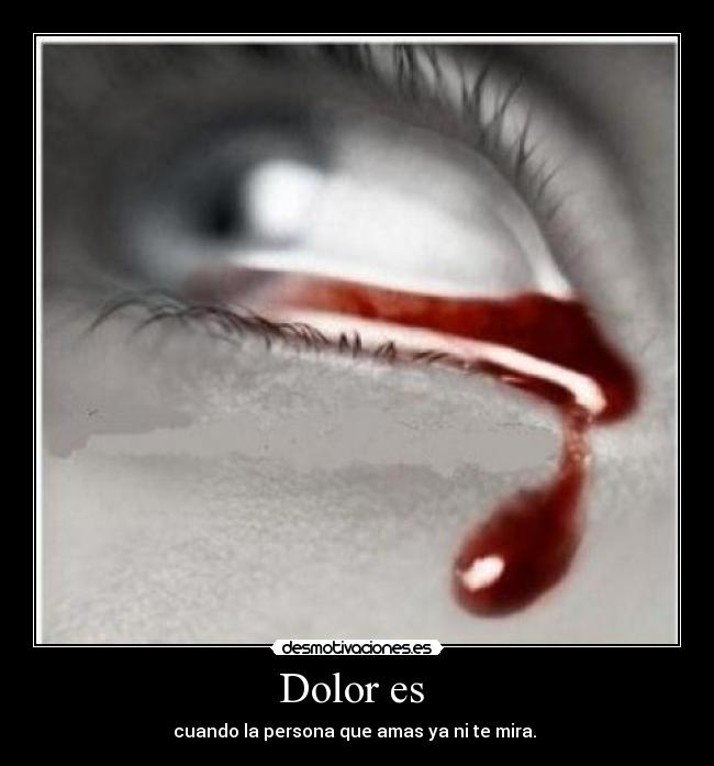 Dolor es  - 