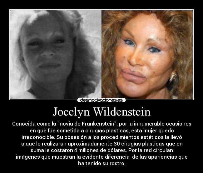 Jocelyn Wildenstein - Conocida como la novia de Frankenstein, por la innumerable ocasiones
en que fue sometida a cirugías plásticas, esta mujer quedó
irreconocible. Su obsesión a los procedimientos estéticos la llevó
a que le realizaran aproximadamente 30 cirugías plásticas que en
suma le costaron 4 millones de dólares. Por la red circulan
imágenes que muestran la evidente diferencia de las apariencias que
ha tenido su rostro.