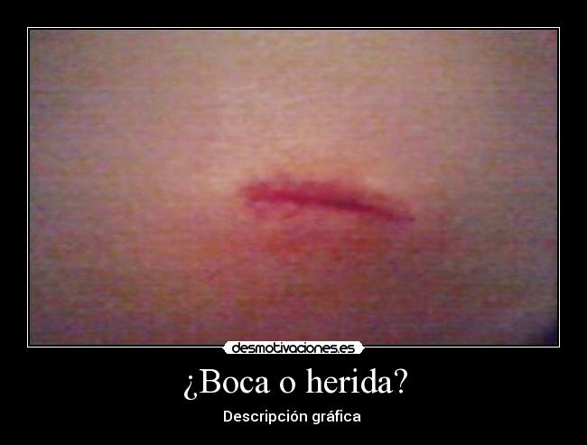 ¿Boca o herida? -