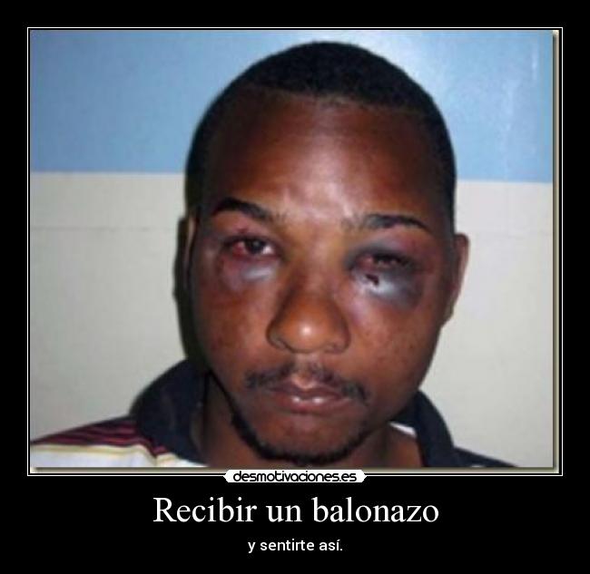 Recibir un balonazo - y sentirte así.