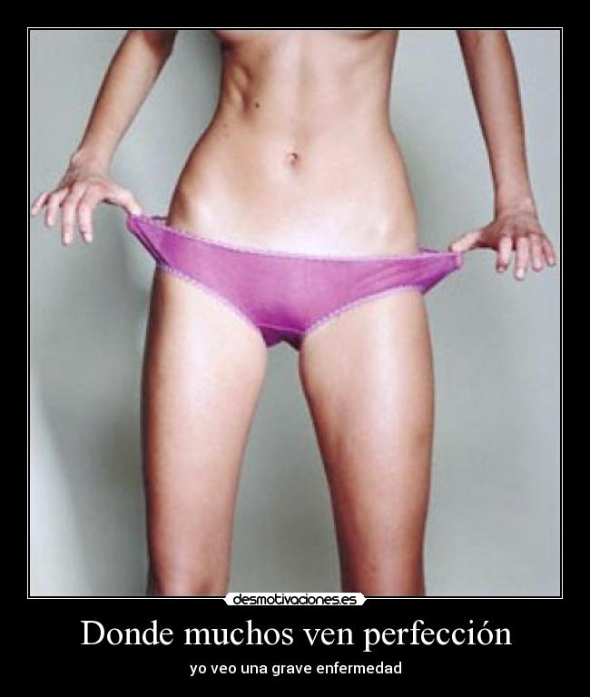 Donde muchos ven perfección - 