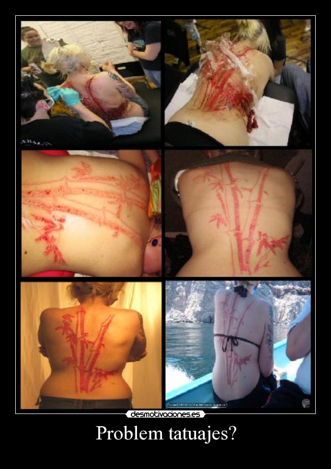 Problem tatuajes? -
