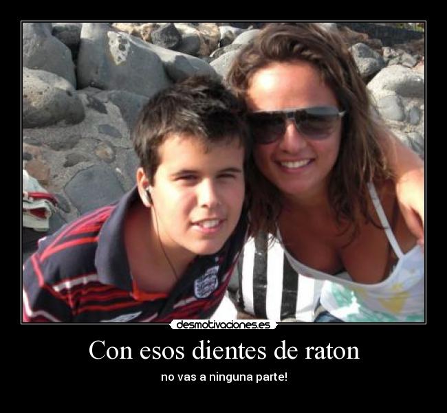 Con esos dientes de raton - 