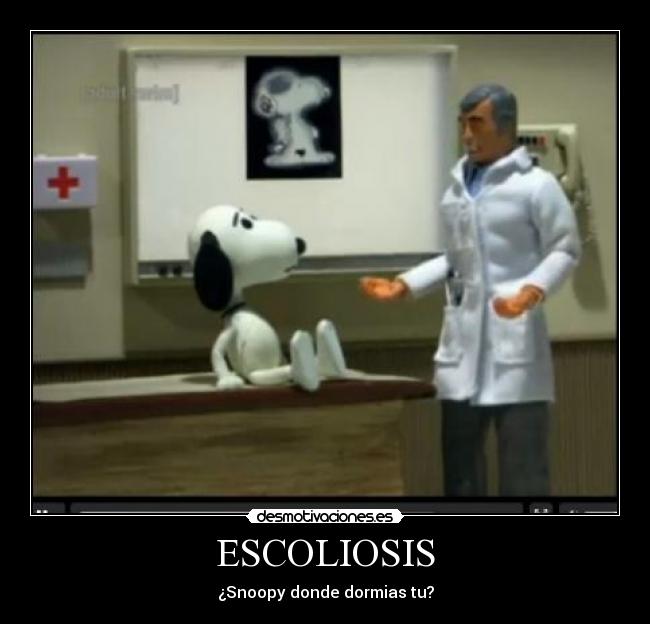 ESCOLIOSIS - ¿Snoopy donde dormias tu?
