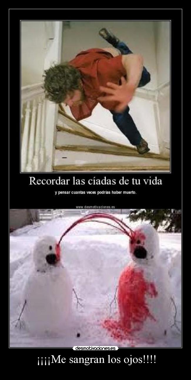 ¡¡¡¡Me sangran los ojos!!!! -