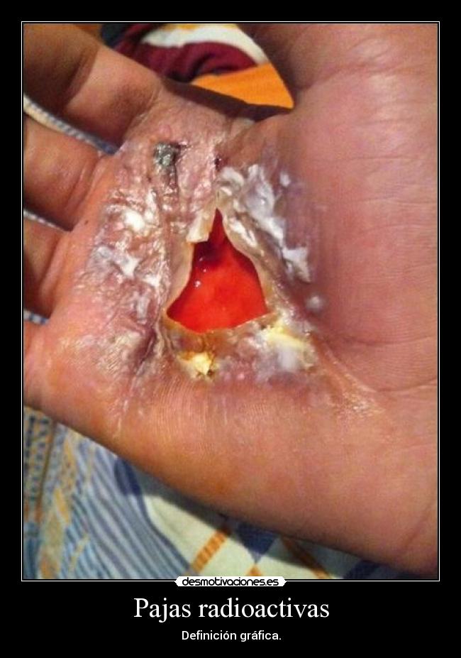 Pajas radioactivas -
