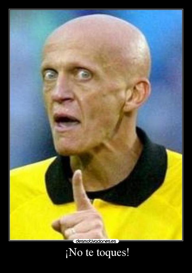 ¡No te toques! -