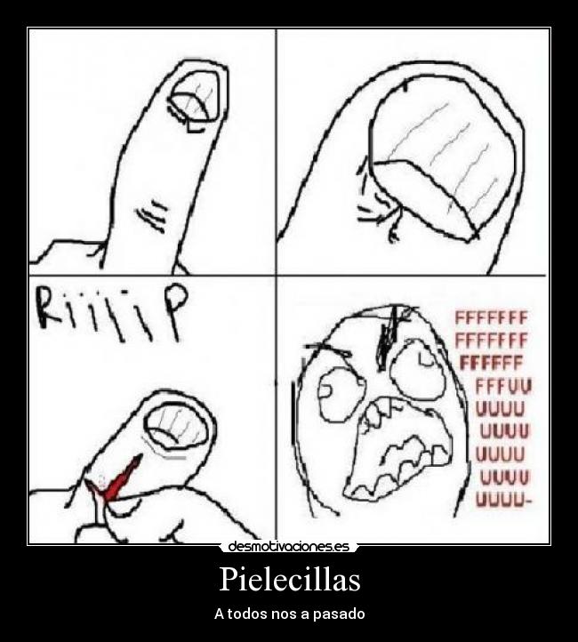 Pielecillas - A todos nos a pasado