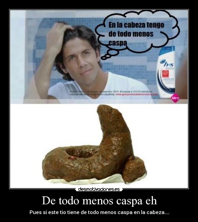 De todo menos caspa eh -