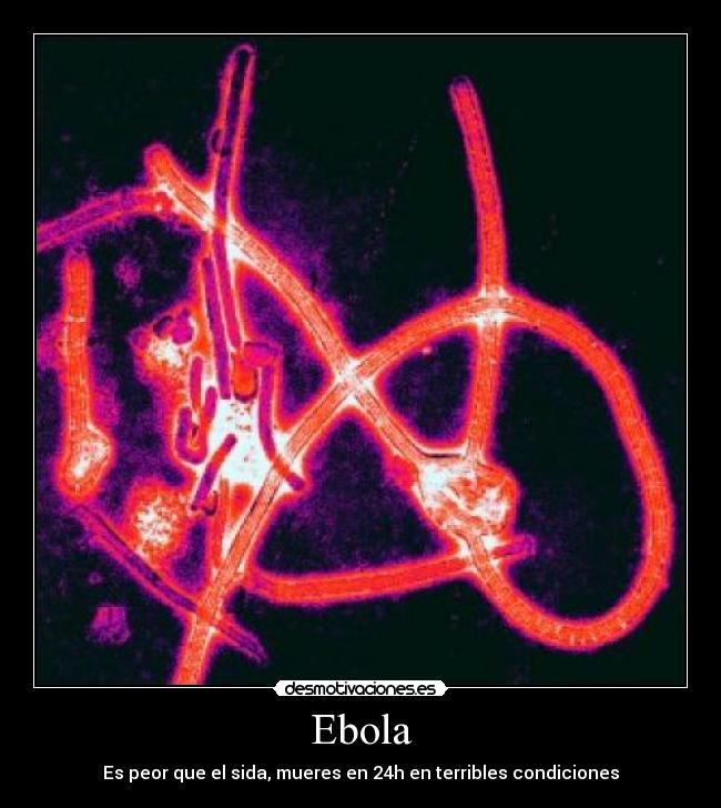 Ebola - Es peor que el sida, mueres en 24h en terribles condiciones