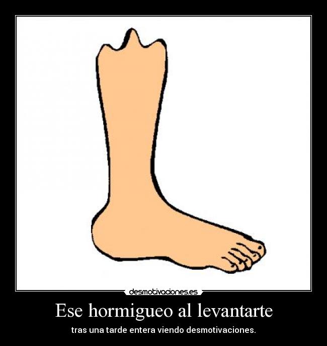 Ese hormigueo al levantarte - 