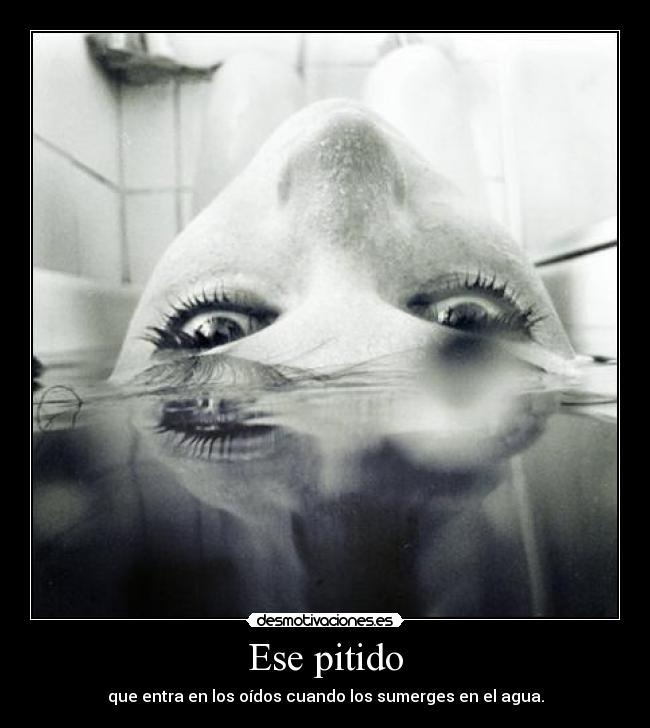 Ese pitido - que entra en los oídos cuando los sumerges en el agua.