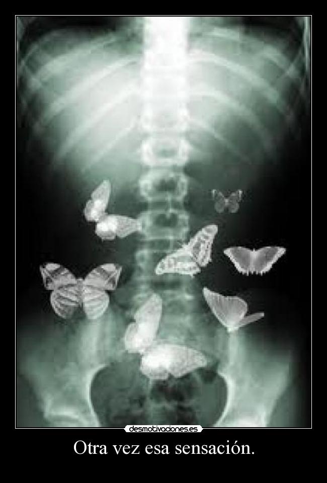 Otra vez esa sensación. -