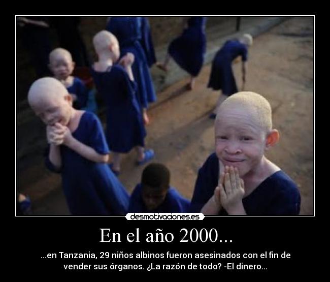 En el año 2000... - ...en Tanzania, 29 niños albinos fueron asesinados con el fin de
vender sus órganos. ¿La razón de todo? -El dinero...