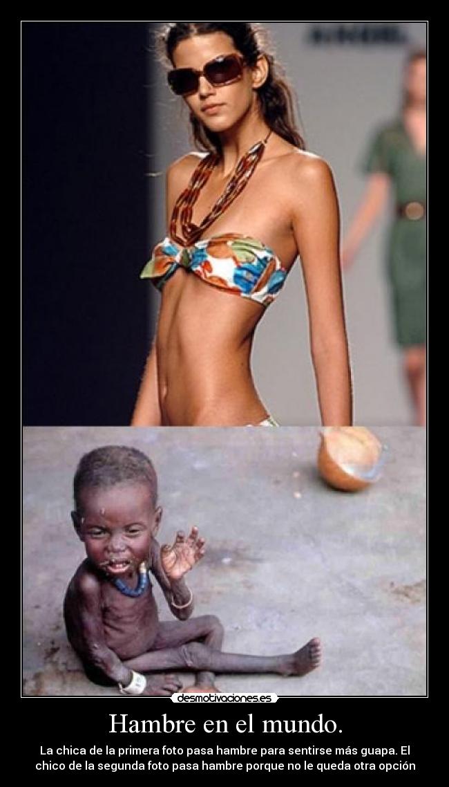 Hambre en el mundo. -