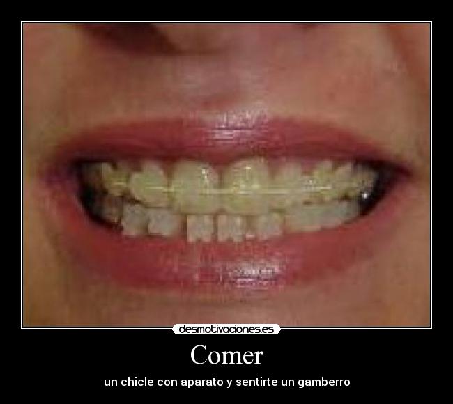 Comer - un chicle con aparato y sentirte un gamberro